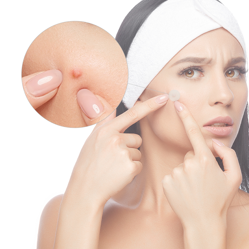 Acne Patch